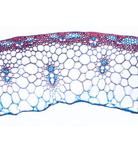 Angiospermae IV. Stems - Portuguese Slides