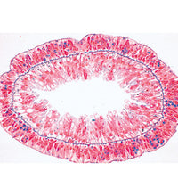 Coelenterata and Porifera - English Slides