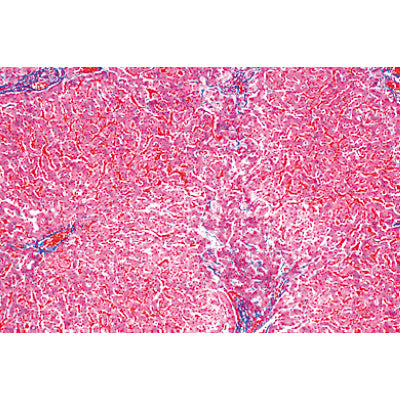 Human Pathology - German Slides