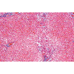 Human Pathology - German Slides