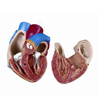 Spare heart, 2 parts