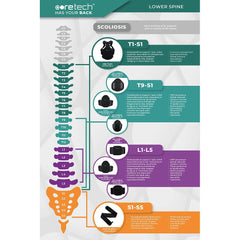 Spine Chart Poster