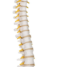 3B Scientific Anatomical Model - 2 Lumbar Vertebrae with prolapsed disc, flexibly mounted - Includes 3B Smart Anatomy