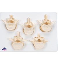 Set of  5 BONElike Lumbar Vertebrae - 3B Smart Anatomy