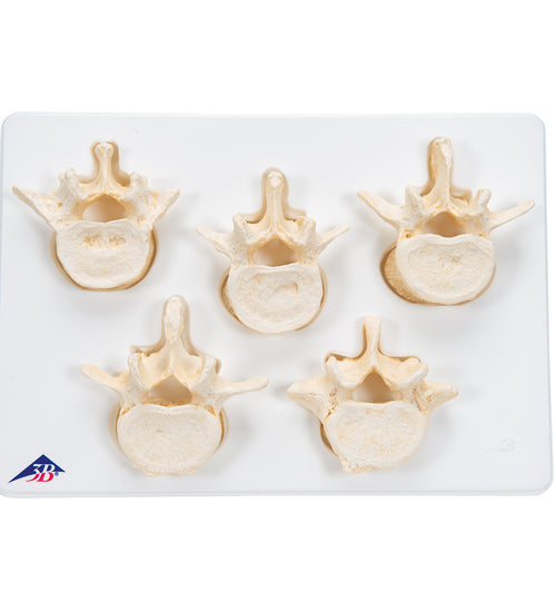 Set of  5 BONElike Lumbar Vertebrae - 3B Smart Anatomy