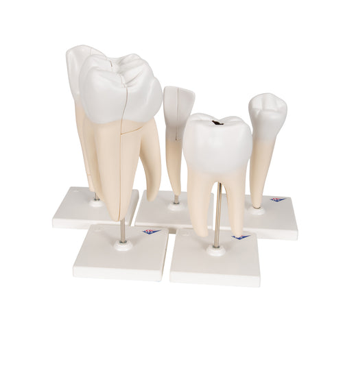 Human Tooth Models Set "Classic Series", 5 Models  - 3B Smart Anatomy