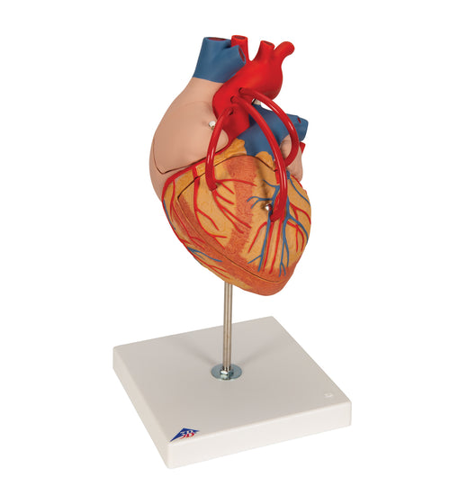 Human Heart Model with Bypass, 2 times Life-Size, 4 part - 3B Smart Anatomy