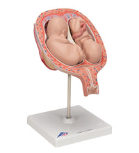Twin Fetuses Model, 5th Month in Normal Position - 3B Smart Anatomy