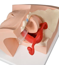 Model for GynaecologicalPatient Education - 3B Smart Anatomy
