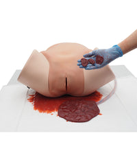 Postpartum Hemorrhage Simulator – PPH Trainer P97 PRO
