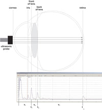 Model Eye for Ultrasonic Biometry