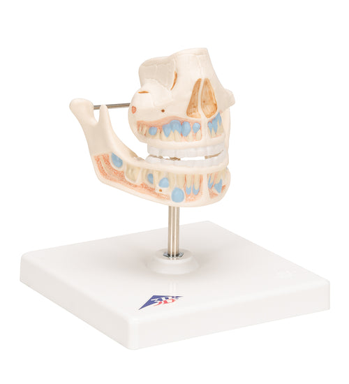 Milk Denture Model with Remaining Teeth - 3B Smart Anatomy