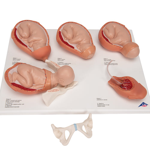 Labor Stages Model, Small - 3B Smart Anatomy