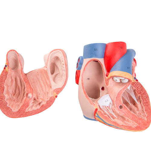 G15: Replacement Heart