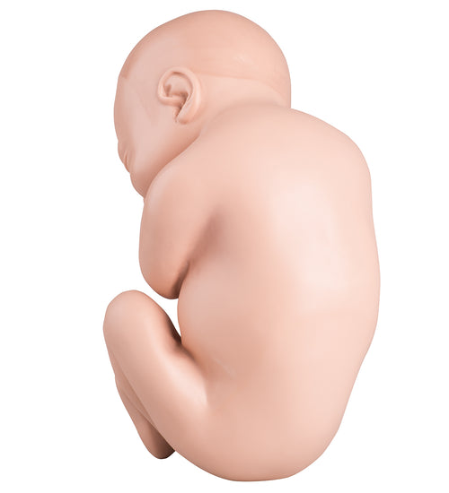 Spare fetus for L20