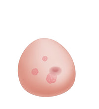 SONOtrain Ultrasound Chest Model with Tumors – Spare Chest