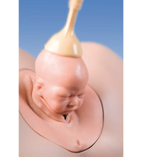 Vacuum Extractor Menox 60mm for SIMone