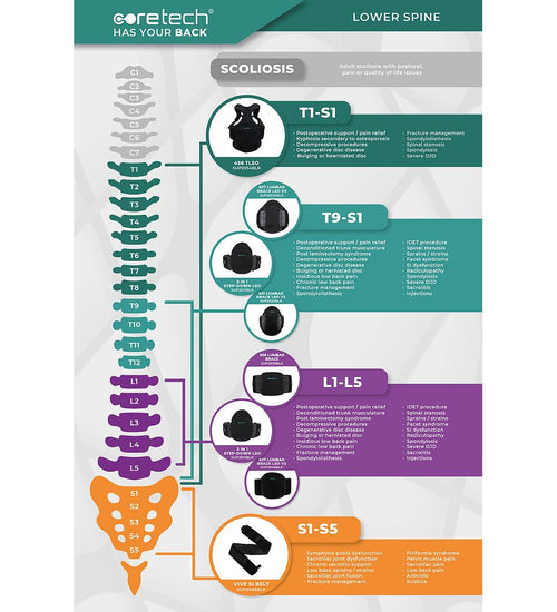 Spine Chart Poster