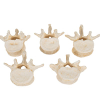 Set of  5 BONElike Lumbar Vertebrae - 3B Smart Anatomy
