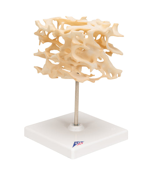 Human Cancellous Bone Model, Enlarged 100 times - 3B Smart Anatomy