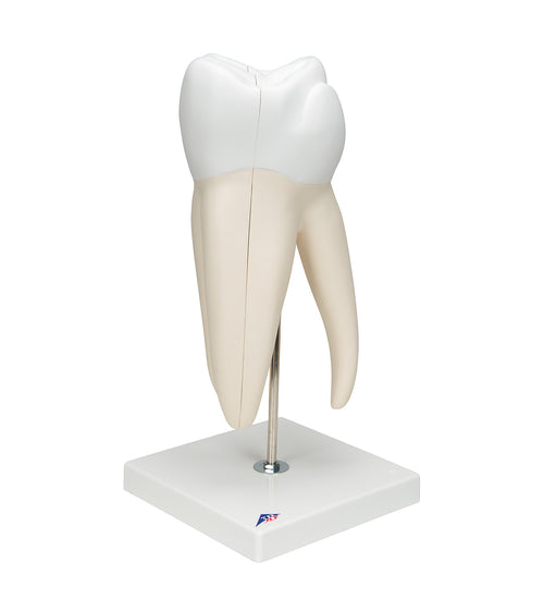 Giant Molar with Dental Cavities Human Tooth Model, 15 times Life-Size, 6 part - 3B Smart Anatomy