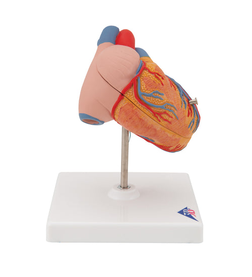 Classic Human Heart Model with Left Ventricular Hypertrophy (LVH), 2 part - 3B Smart Anatomy