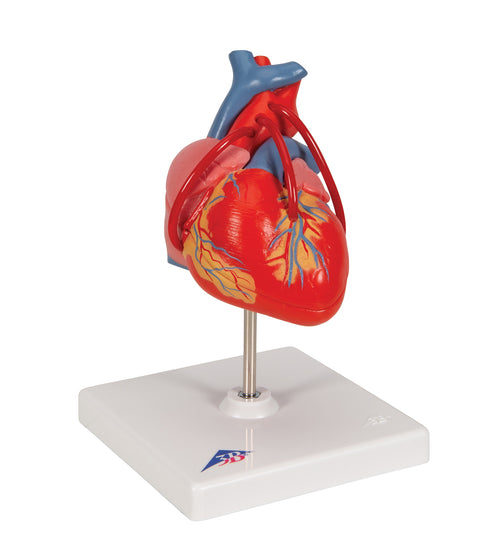 Classic Human Heart Model with Bypass, 2 part - 3B Smart Anatomy