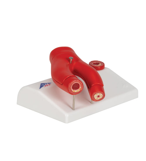 Arteriosclerosis Model, with Cross Section of Artery, 2 part - 3B Smart Anatomy