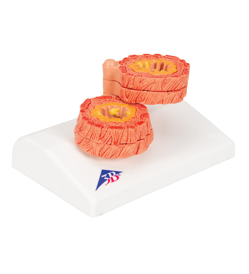 COPD Bronchial Tissue Model - 3B Smart Anatomy