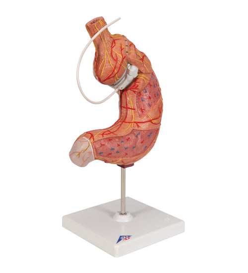 Human Stomach Model with Gastric Band, 2 part - 3B Smart Anatomy