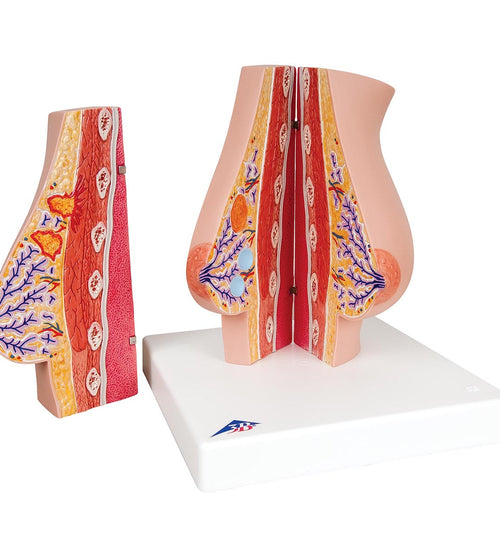 Model of Female Breast with Healthy & Unhealthy Tissue - 3B Smart Anatomy