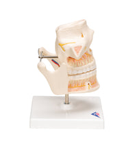 Adult Denture Model with Nerves and Roots - 3B Smart Anatomy