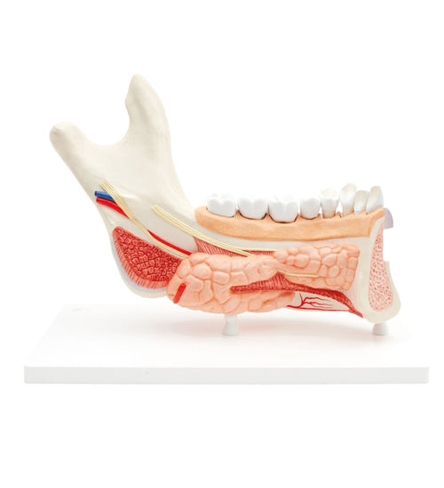 Comprehensive Lower Jaw Model (Left Half) with Diseased Teeth, Nerves, Vessels & Glands, 19 part - 3B Smart Anatomy