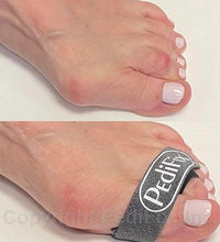 Hammer ToeStrap™, 2/pk