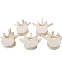 Set of  5 BONElike Lumbar Vertebrae - 3B Smart Anatomy