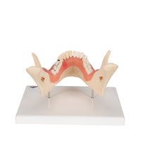 Dental Disease Model, Magnified 2 times, 21 parts - 3B Smart Anatomy