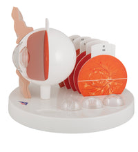 Pathological Human Eye Model - 3B Smart Anatomy