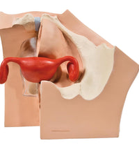 Model for GynaecologicalPatient Education - 3B Smart Anatomy