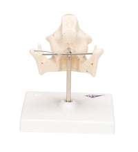 Milk Denture Model with Remaining Teeth - 3B Smart Anatomy