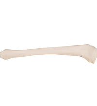 Human Tibia Model- 3B Smart Anatomy