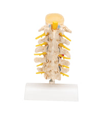 Stages of Disc Prolapse and Vertebral Degeneration - 3B Smart Anatomy