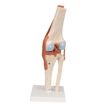 Functional Human Knee Joint Model with Ligaments & Marked Cartilage - 3B Smart Anatomy