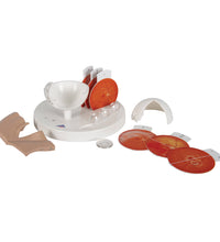 Pathological Human Eye Model - 3B Smart Anatomy