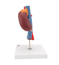 Human Kidneys Model with Vessels - 2 Part - 3B Smart Anatomy