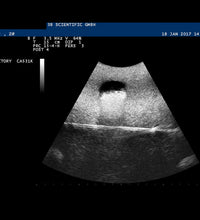 SONOtrain Ultrasound Vein model