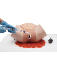 Postpartum Hemorrhage Simulator – PPH Trainer P97 PRO