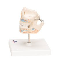 Milk Denture Model with Remaining Teeth - 3B Smart Anatomy