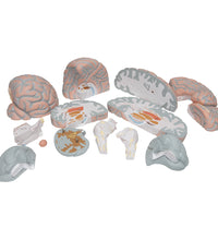 Giant Human Brain Model, 2.5 times Full-Size, 14 part - 3B Smart Anatomy