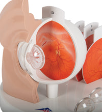 Pathological Human Eye Model - 3B Smart Anatomy