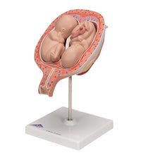Twin Fetuses Model, 5th Month in Normal Position - 3B Smart Anatomy